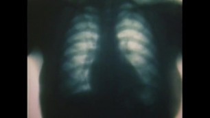 [x-ray] Female Heart Pounding hardly